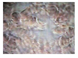 blood, Aqua Chi,Aqua Chi Detoxification,
