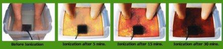 Detox Foot Spa, Detox Foot Bath, Ion Detox Foot Spa,